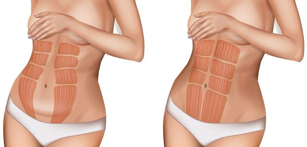 a comparison of women's body