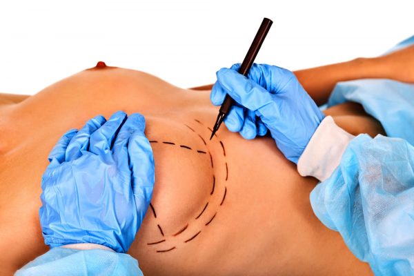 Hybrid Breast Augmentation London